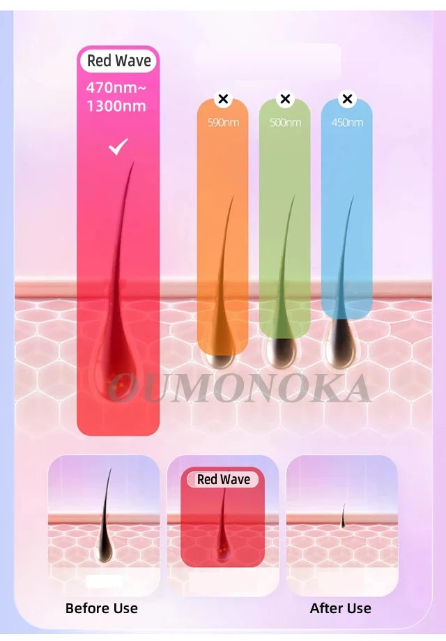 IPL Hair Removal Device – Painless At-Home Laser Hair Removal for Smooth Skin