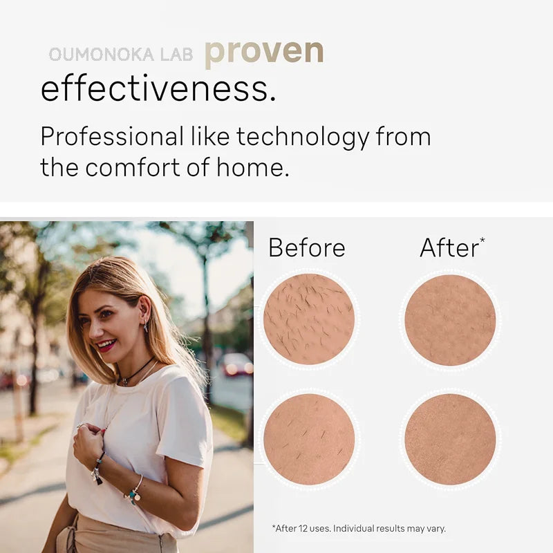 IPL Hair Removal Device – Painless At-Home Laser Hair Removal for Smooth Skin